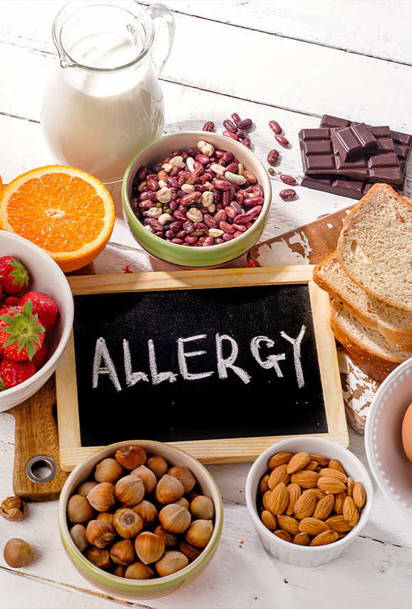 Photo of common foods associated with food allergies